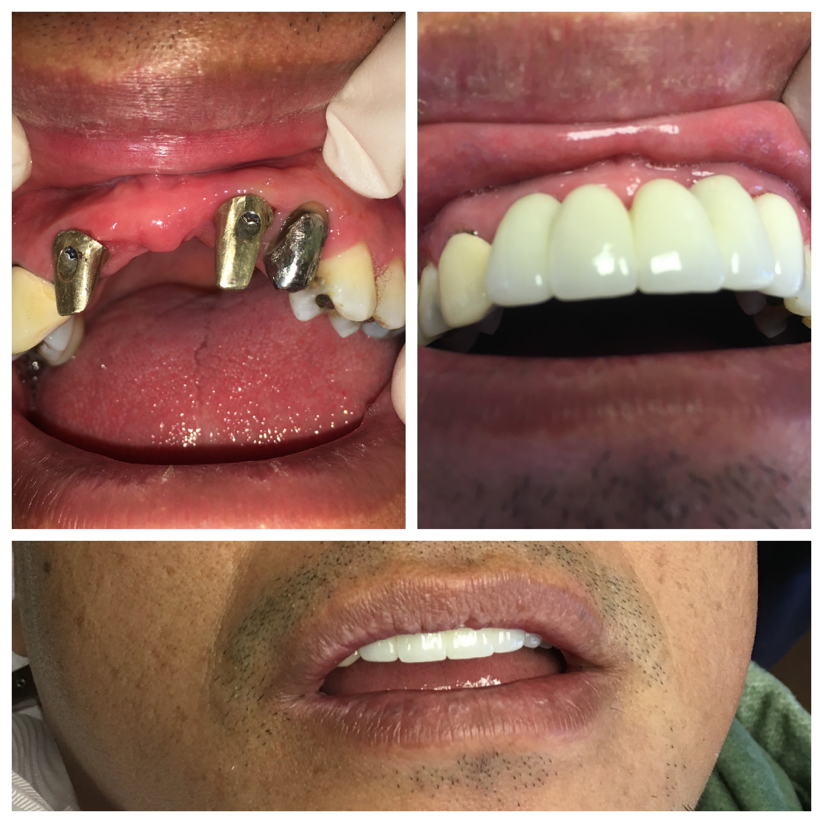 Smile Gallery West Hempstead, NY Ashu Sachdev, DDS